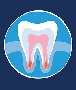 Incision and Drainage