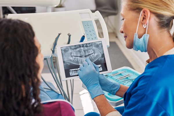 Root Canal Recovery: What To Expect After Undergoing Therapy